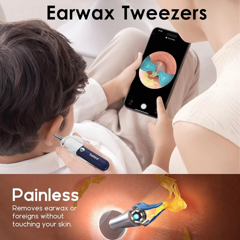 Visual Ear Cleaner | Smart Otoscope & Earpick Kit